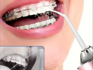 Portable Electric Water Flosser, With 4Nozzles, UsB Charging, 3 Smart Modes,Fully Automatic Handheld Oral lrrigator,Dental Clean